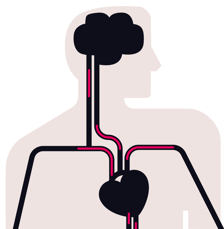 Figura Appremia